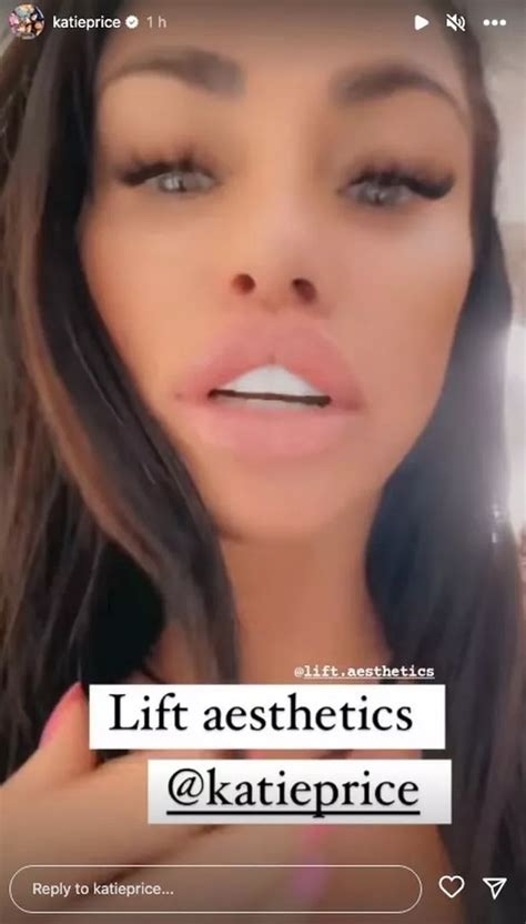 Katie Prices veneer falls out live on her TikTok